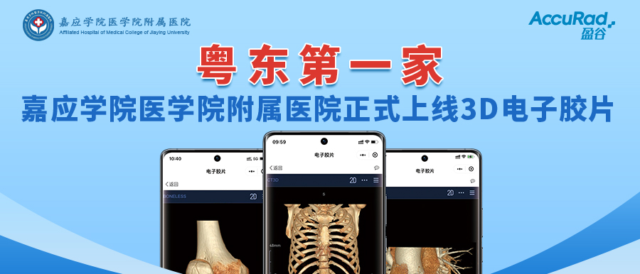 “手機掃一掃，云端影像隨時(shí)看”！盈谷網(wǎng)絡(luò )助力嘉應學(xué)院醫學(xué)院附屬醫院3D電子膠片正式上線(xiàn)！